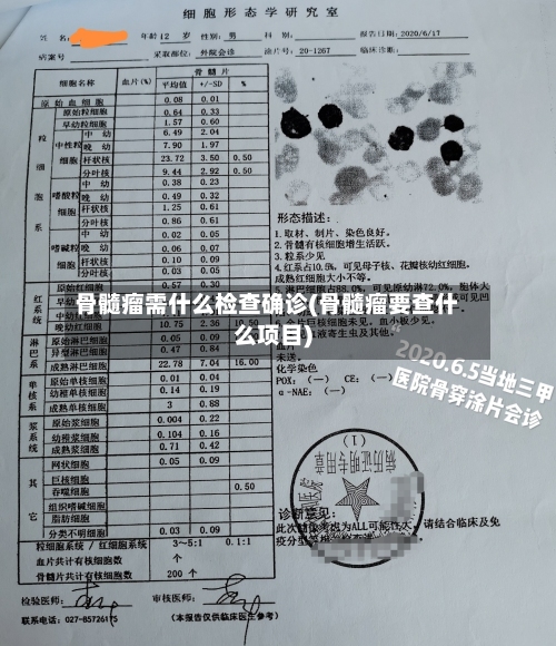 骨髓瘤需什么检查确诊(骨髓瘤要查什么项目)-第1张图片