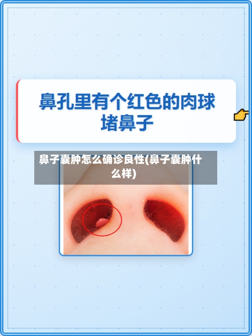 鼻子囊肿怎么确诊良性(鼻子囊肿什么样)-第3张图片