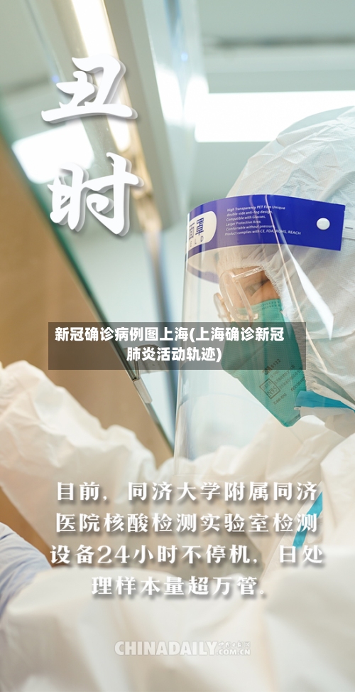 新冠确诊病例图上海(上海确诊新冠肺炎活动轨迹)-第1张图片