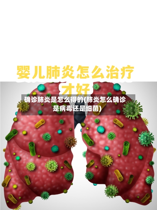 确诊肺炎是怎么得的(肺炎怎么确诊是病毒还是细菌)-第1张图片