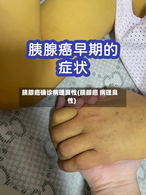 胰腺癌确诊病理良性(胰腺癌 病理良性)-第1张图片